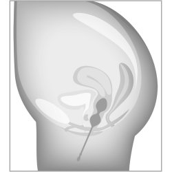 ELORIN venjingarsett vi� k�lum